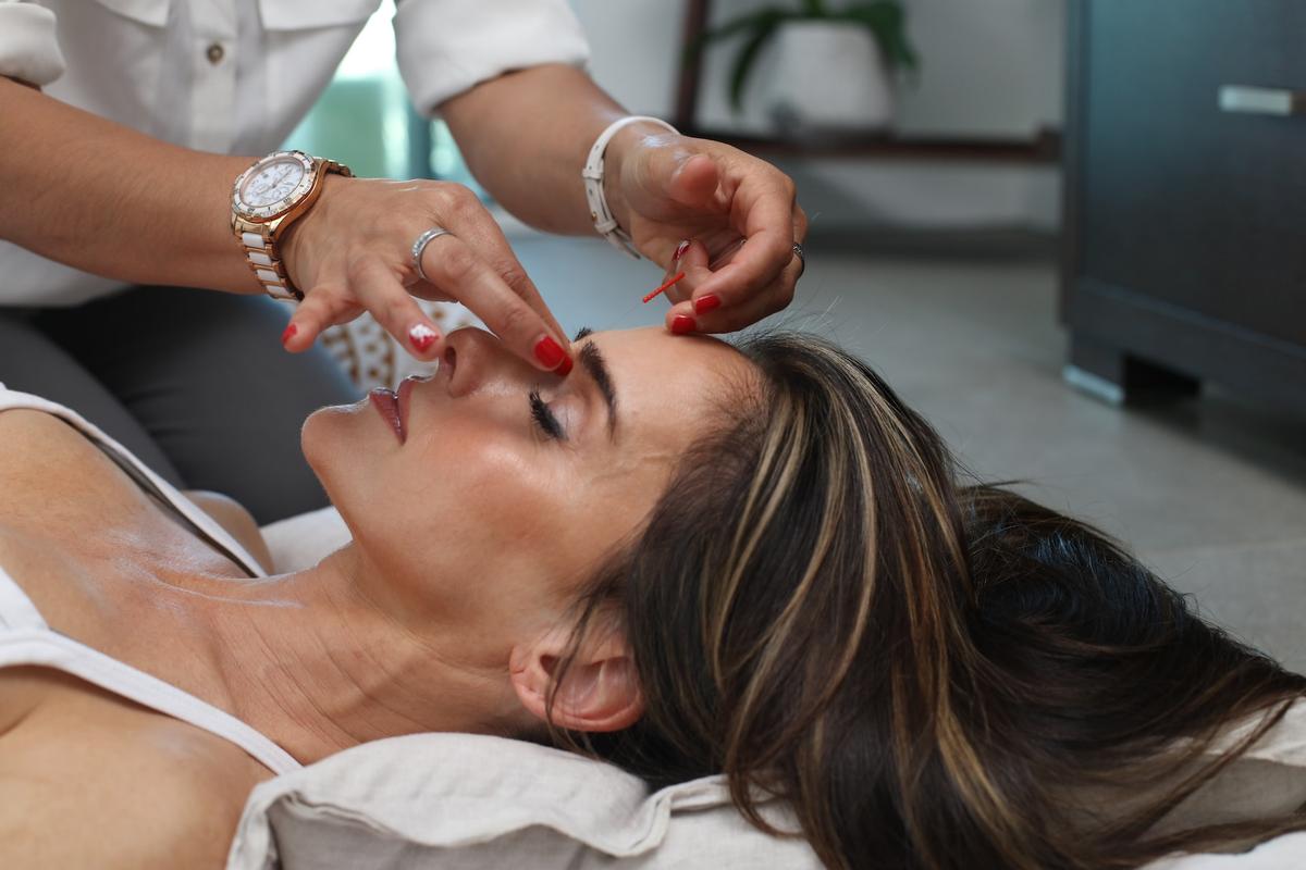 A close-up of a woman receiving facial acupuncture from a practitioner.