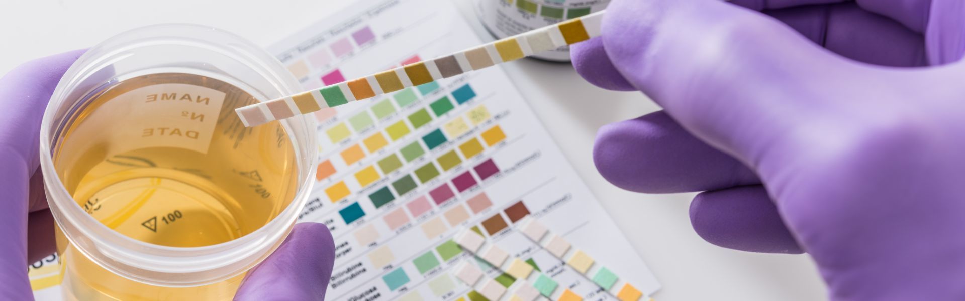 Navigating Pre-Employment Drug Screening: Identifying the Substances Tested hero image